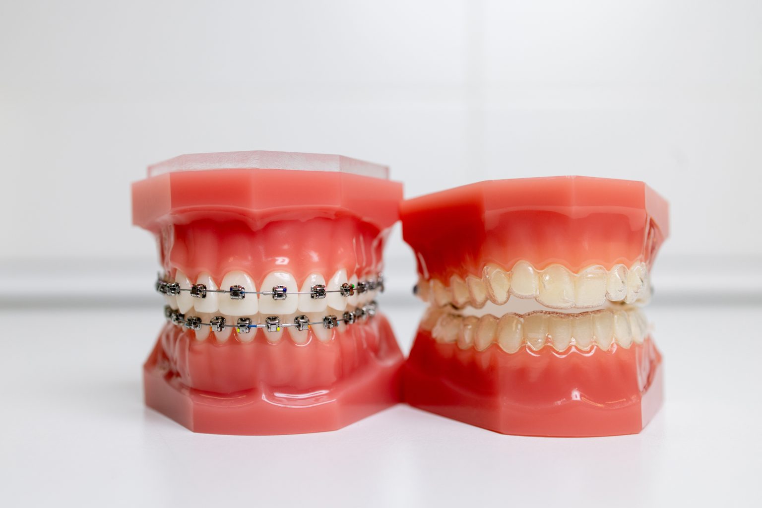 Clear Aligners vs. Traditional Braces: Pros and Cons - The Dental ...