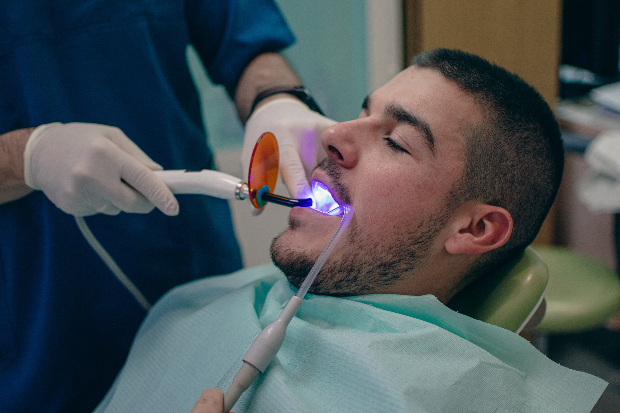 Dental Bonding in Encino – Transform Your Smile