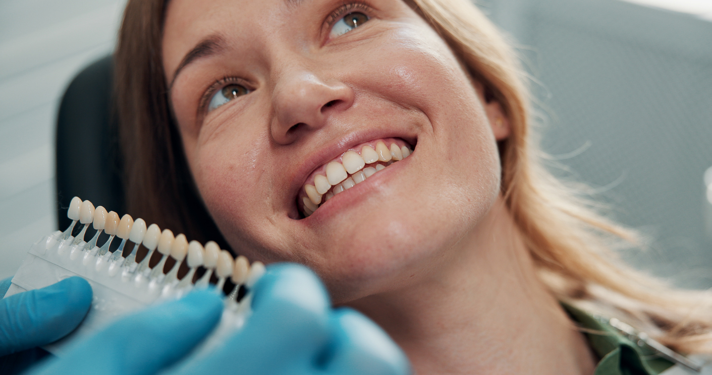 Is Dental Bonding Right for Your Smile
